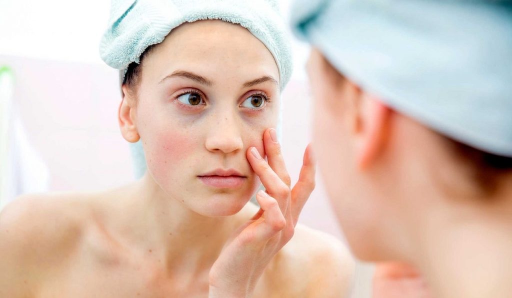 Gözaltı Morluğu Nedir? Nedenleri ve Tedavisi Nelerdir?