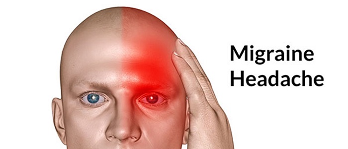 Migrenin Evreleri (Dönemleri)
