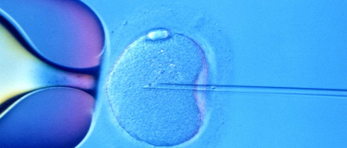 Kısırlığın Tedavisi Nedir?