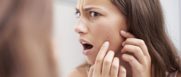 Siyah Noktalar Neden Oluşur?