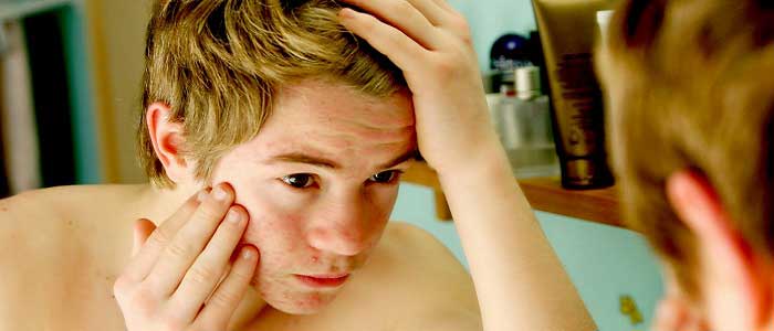 Erkeklerde Ergenlik Belirtileri Nelerdir?