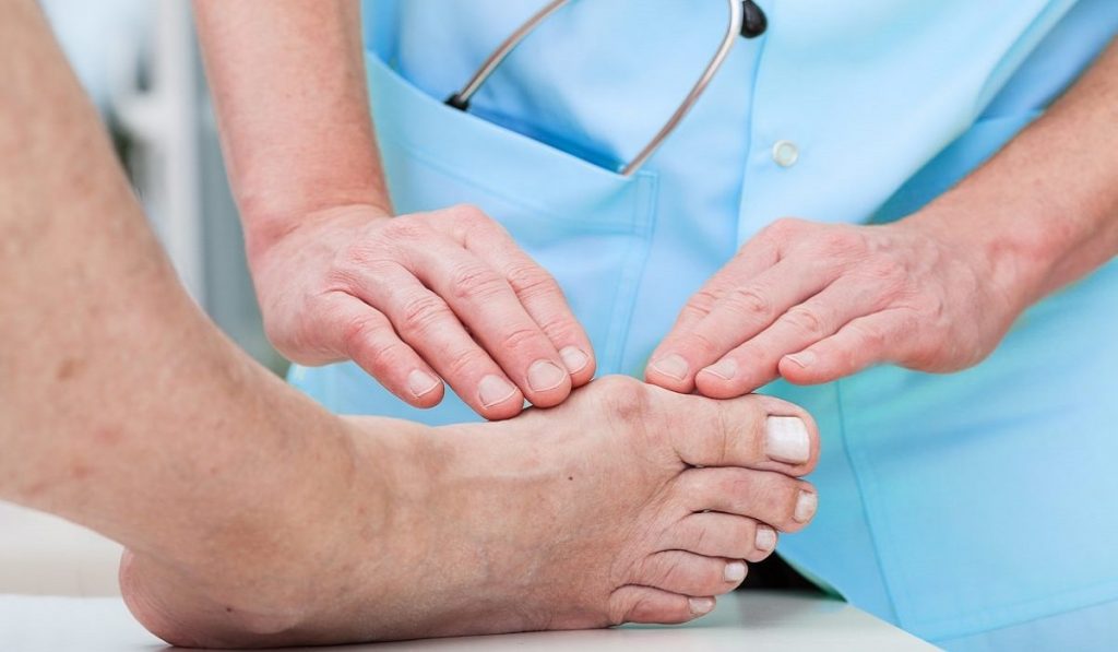 Gut Hastalığı Nedir? Nedenleri, Belirtileri, Korunma Yolları ve Tedavisi Nelerdir?