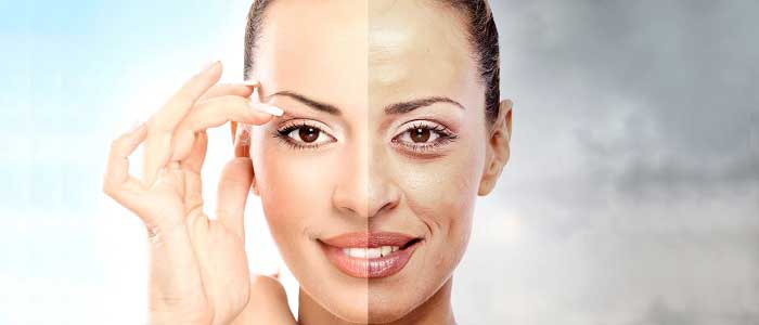 Peeling Öncesi ve Sonrası