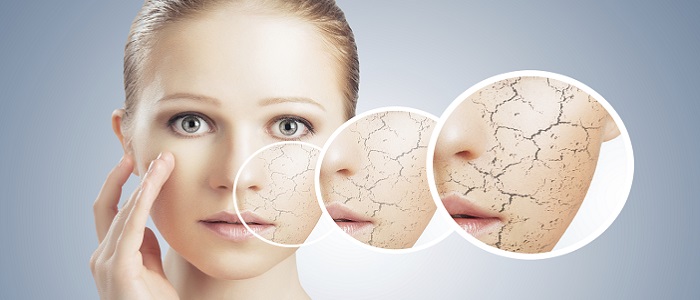 Cilt Kuruluğunun Nedenleri Nelerdir?