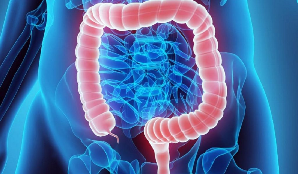 Kolon (Kalın Bağırsak) Kanseri Nedir? Nedenleri, Belirtileri, Korunma Yolları ve Tedavisi