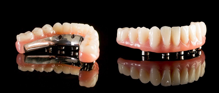 Protez Diş (Diş Protezi) Nedir?