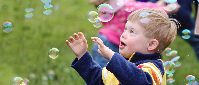 Down Sendromunun Belirtileri Nelerdir?