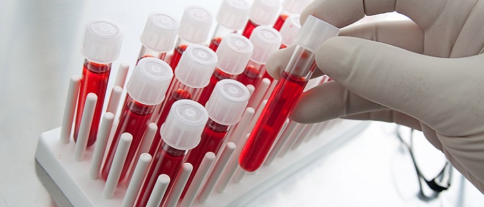 Anemi (Kansızlık) Nedir?