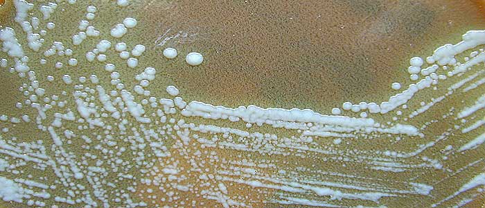 Tularemi Hastalığı Nedir?