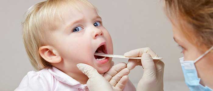 Tularemi Hastalığının Tedavisi Nedir?