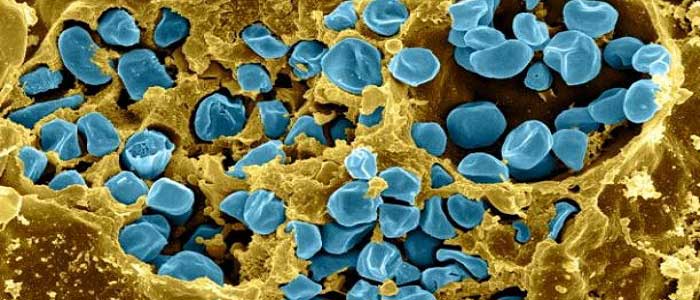 Tularemi Hastalığının Nedenleri Nelerdir?