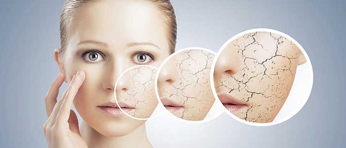 Kükürtlü Sabunun Yan Etkileri Nelerdir?