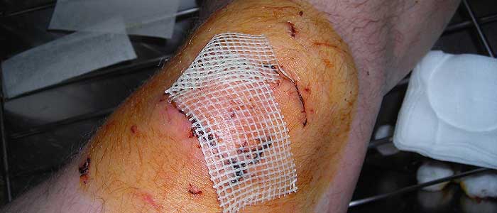 Tentürdiyodun Faydaları Nelerdir?