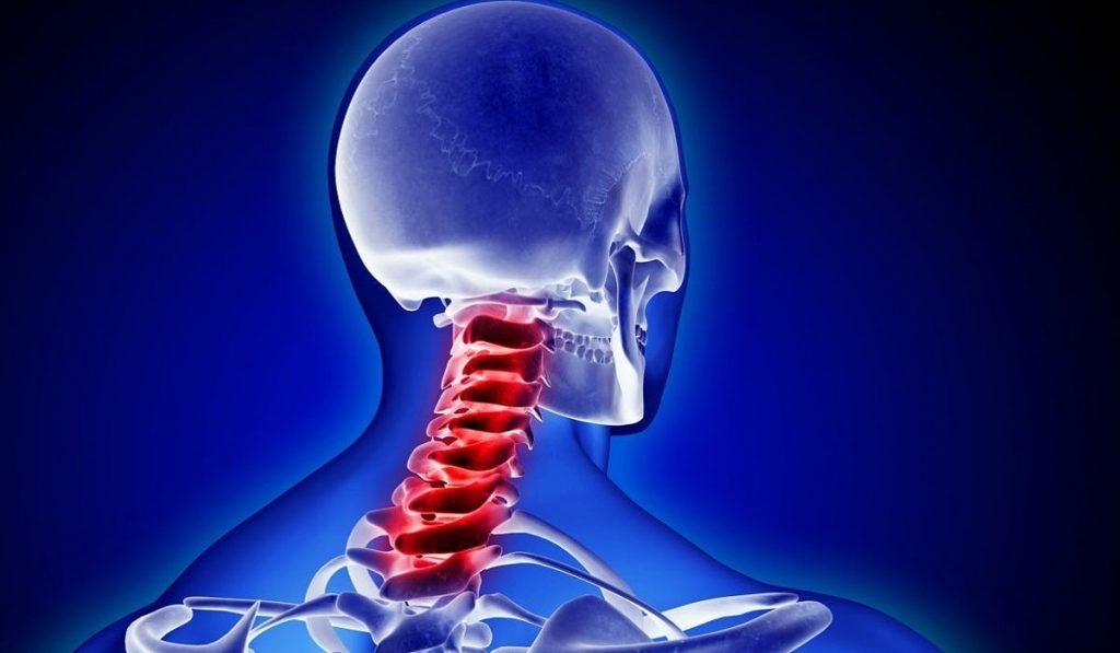 Boyun Fıtığı Nedir? Nedenleri, Belirtileri, Korunma Yolları ve Tedavisi