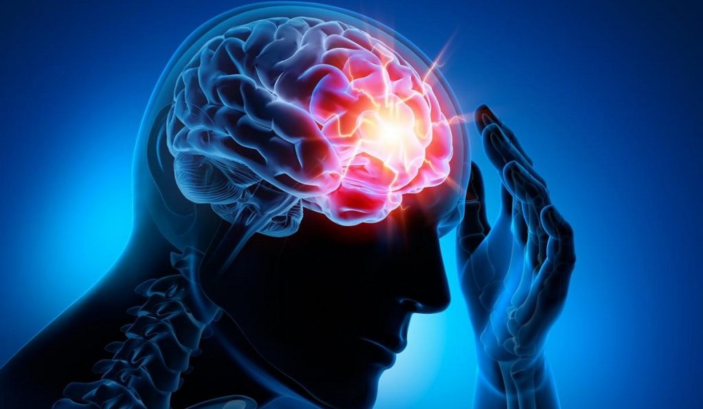 Epilepsi (Sara) Hastalığı Nedir? Nedenleri, Belirtileri, Korunma Yolları ve Tedavisi