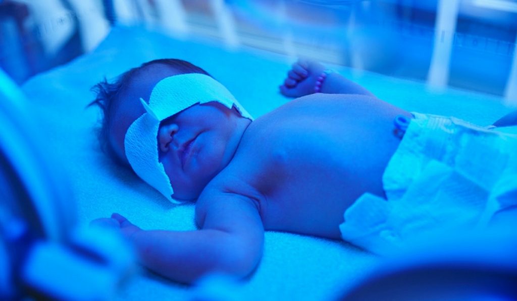 Anne Sütü Sarılığı Nedir? Nedenleri, Belirtileri, Korunma Yolları ve Tedavisi