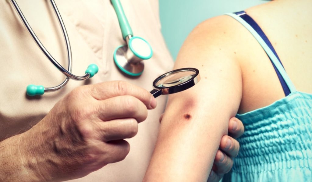 Cilt (Deri) Kanseri Nedir? Nedenleri, Belirtileri, Korunma Yolları ve Tedavisi