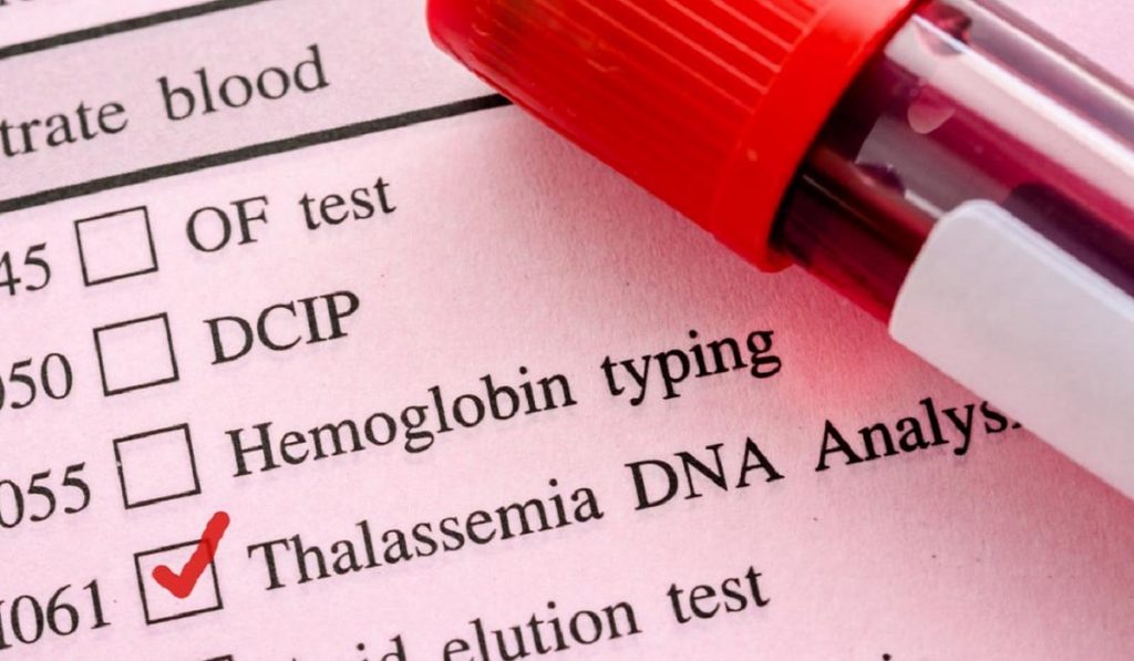 Akdeniz Anemisi (Talasemi) Nedir? Nedenleri, Belirtileri, Korunma Yolları ve Tedavisi